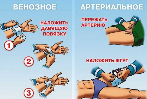 Первая медицинская помощь, или Как действовать очевидцу при ДТП