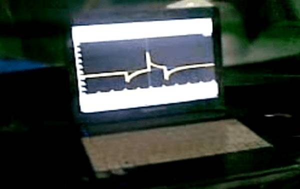 Способы проверки автомобильной катушки зажигания Способы проверки автомобильной катушки зажигания